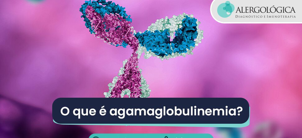 ALERGOLÓGICA-Blog_Agamaglobulinemia