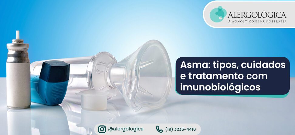 Alergologica - Blog - Asma - Tipos Mitos e Imunobiologicos