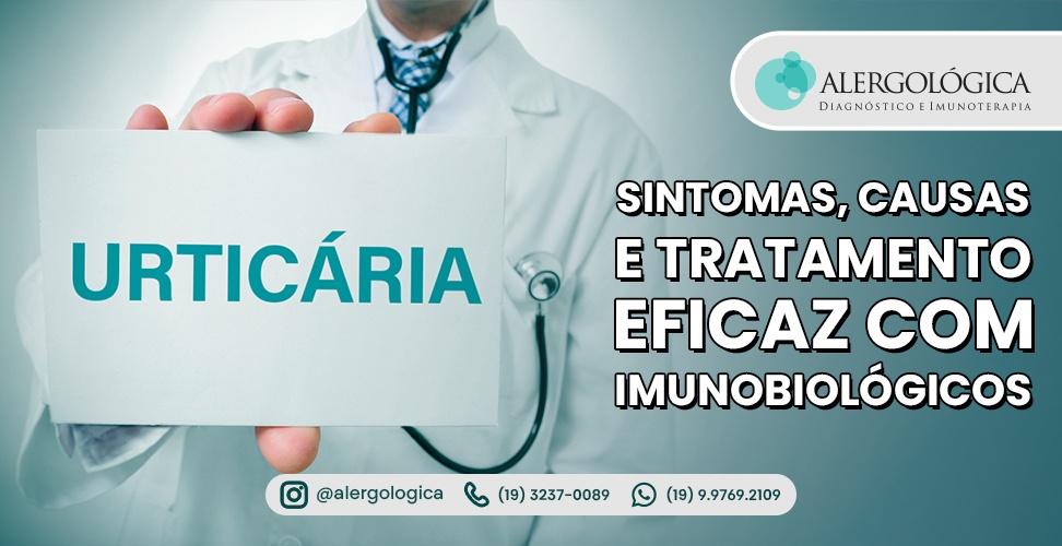 ALERGOLOGICA - Blog da Clinica - Urticaria - capa