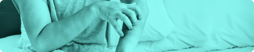 Clinica Alergologica - Blog - Urticaria e Urticaria Cronica - imagens internas (2)