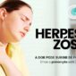 ALERGOLOGICA - Blog - Herpes Zoster