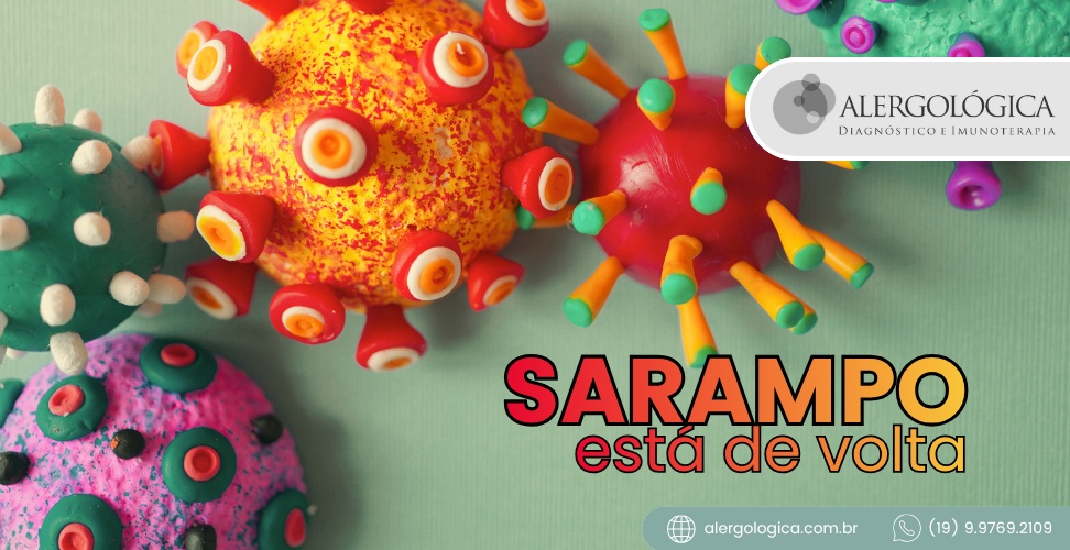 ALERGOLÓGICA - blog - Sarampo esta de volta